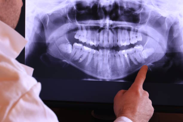 Best Emergency Gum Treatment in Harmony, RI