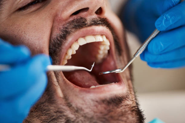 Best Urgent Care for Lost Fillings or Crowns in Harmony, RI