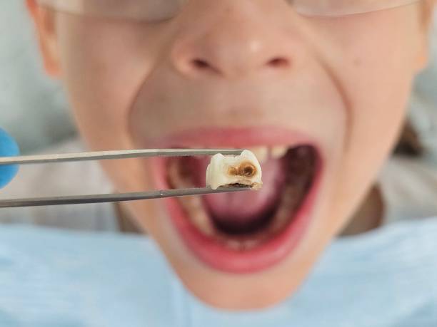 Best Cosmetic Emergency Dentistry in Harmony, RI